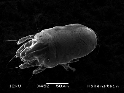 Pic: Detailed image of a house dust mite taken by a scanning electron microscope. © Hohenstein Group Pic: Detailed image of a house dust mite taken by a scanning electron microscope. © Hohenstein Group