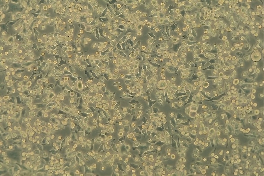 Intact host cells (NCTC) before virus contact (100 x). © 2025 DITF Intact host cells (NCTC) before virus contact (100 x). © 2025 DITF