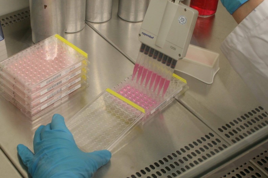 Cell seeding of host cells to determine the number of viruses. © 2025 DITF Cell seeding of host cells to determine the number of viruses. © 2025 DITF