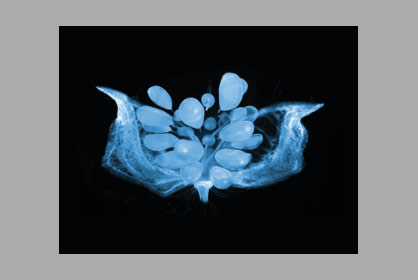 CT-Picture of a Cotton Boll – Deep Insights into Cotton © FIBRE/ MAPEX/ University Bremen* CT-Picture of a Cotton Boll – Deep Insights into Cotton © FIBRE/ MAPEX/ University Bremen*