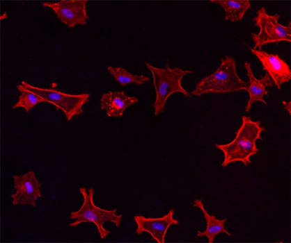 Yoga for connective tissue cells: In the presence of functionalized cellulose, connective tissue cells, as hoped, attach themselves more effectively and spread on the surface. Image: Empa Yoga for connective tissue cells: In the presence of functionalized cellulose, connective tissue cells, as hoped, attach themselves more effectively and spread on the surface. Image: Empa