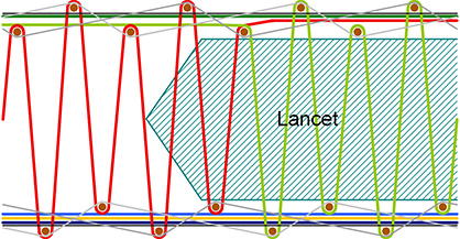 Lancet on a face-to-face carpet loom (c) 2018 Stäubli Lancet on a face-to-face carpet loom (c) 2018 Stäubli