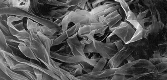 Immature Fiber (c) 2020 Uster Immature Fiber (c) 2020 Uster